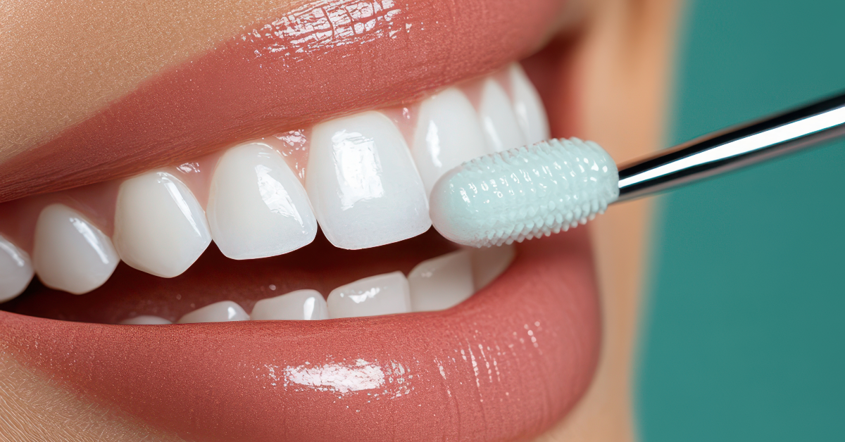 Zirconia Crowns