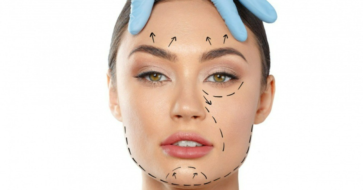 Facelift