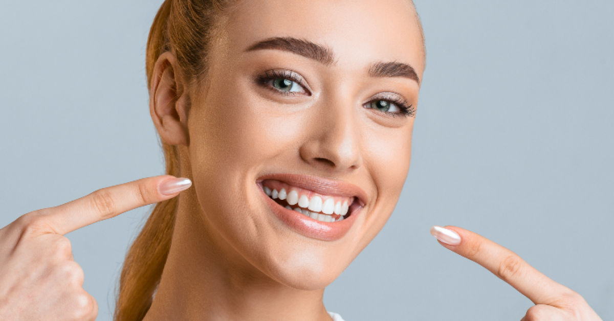 Hollywood Smile