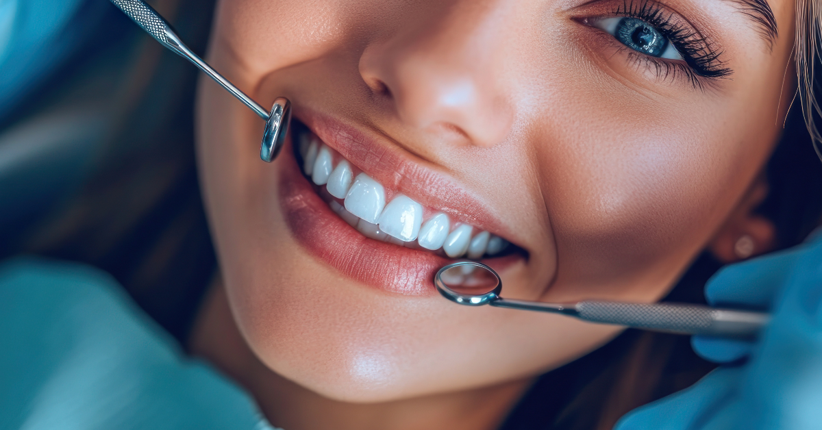 Emax Veneers