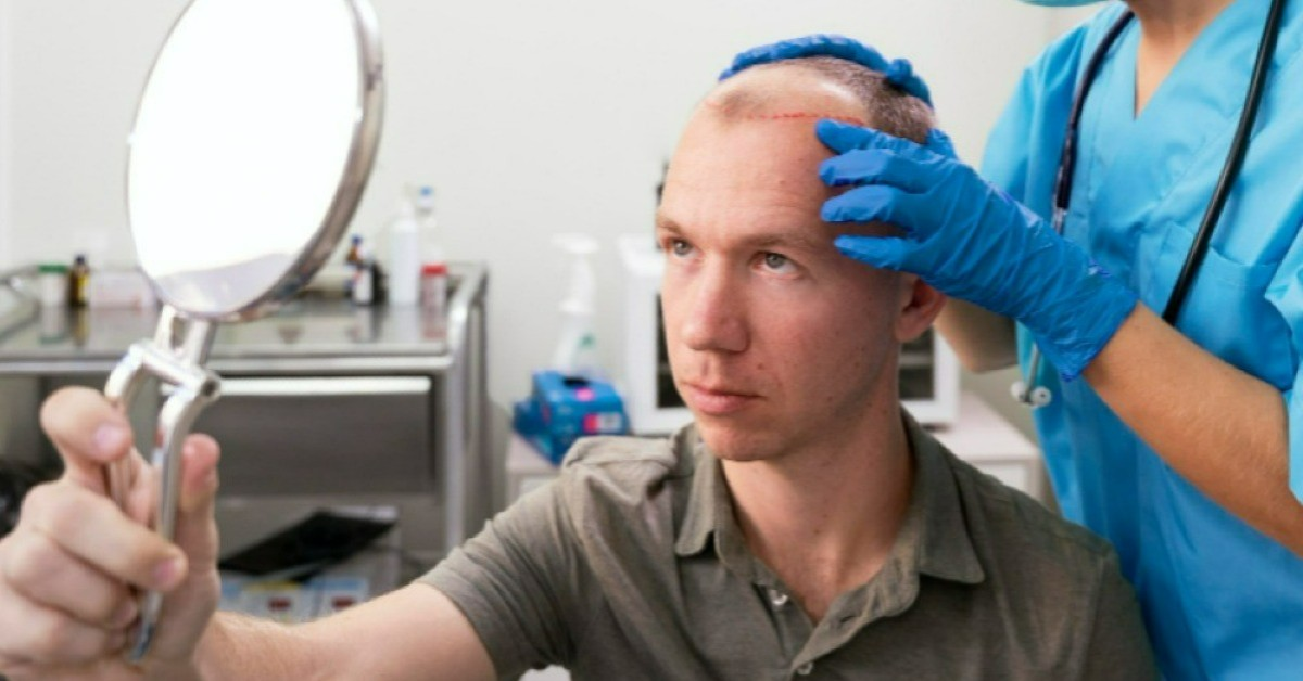 FUE Hair Transplant