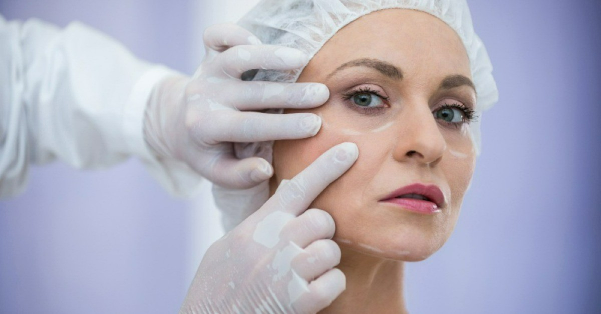 Blepharoplasty