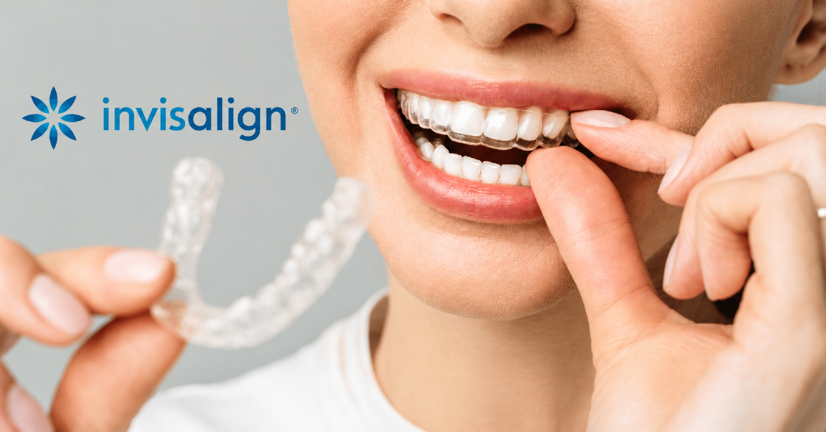 Invisalign Clear Aligner