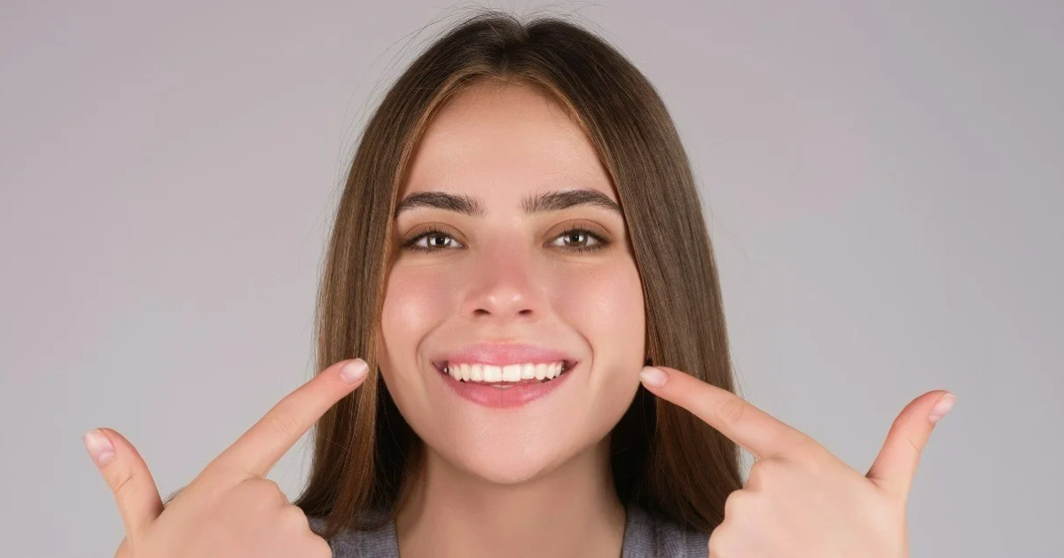 Hollywood smile